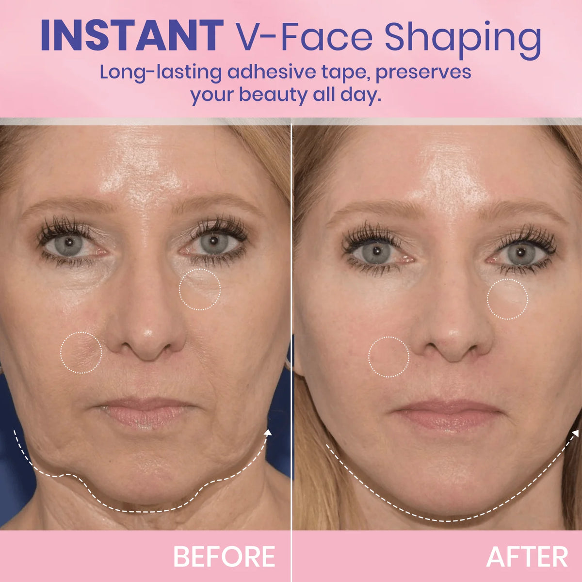 V-Face 👑 Invisible Lifting Tape