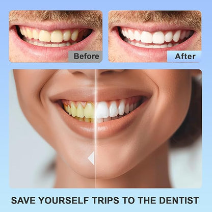 🦷✨ Teeth Whitening Strips Sale — 🔥🔥🔥 Up to 50% OFF