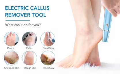 💕👣 Mother’s Day Rechargeable Electric Callus Remover | 3 Speeds F&R Rotation Foot Care
