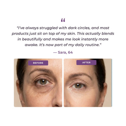 EyeCorrect+ Undereye Brightener