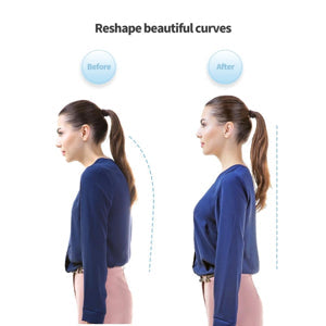🔥 25% OFF Today — Smart Posture Corrector | Vibration Alert, USB Rechargeable, 10-Day Battery