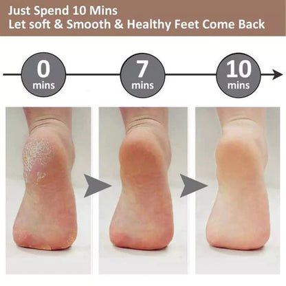 💕👣 Mother’s Day Rechargeable Electric Callus Remover | 3 Speeds F&R Rotation Foot Care
