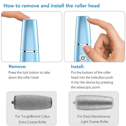 💕👣 Mother’s Day Rechargeable Electric Callus Remover | 3 Speeds F&R Rotation Foot Care
