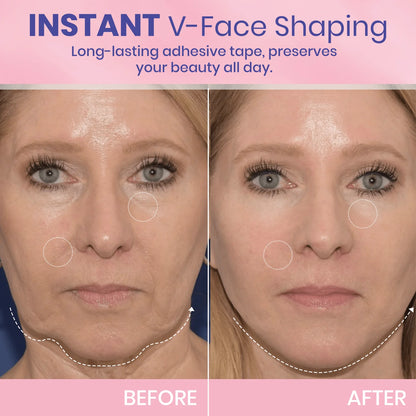 V-Face 👑 Invisible Lifting Tape